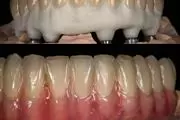 0800Dentistas thumbnail 2