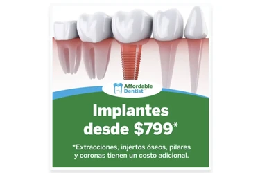 Implantes Dentales desde $799 en Orange County