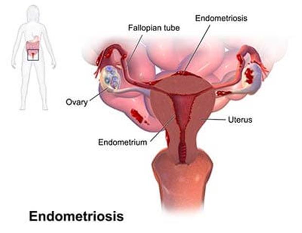 Endometriosis specialists image 3