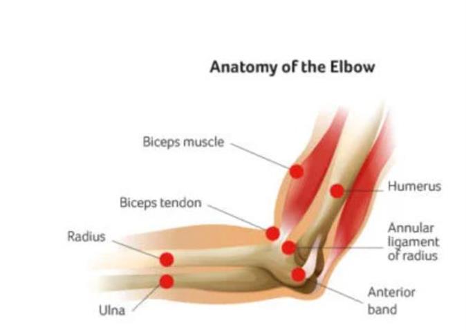 Elbow Pain Treatment in NYC image 2