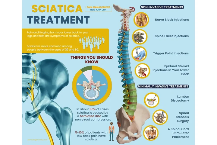 Sciatica Treatment Doctors image 5