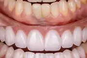 Selfie Smiles Dental Group thumbnail 4