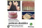 Prótesis dentales domicilio en Santiago