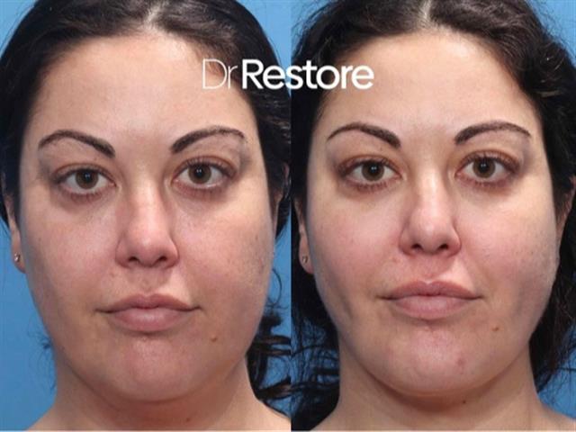 Dr. Restore image 9