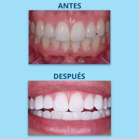 Dr. Soto The Downey Dentist image 9