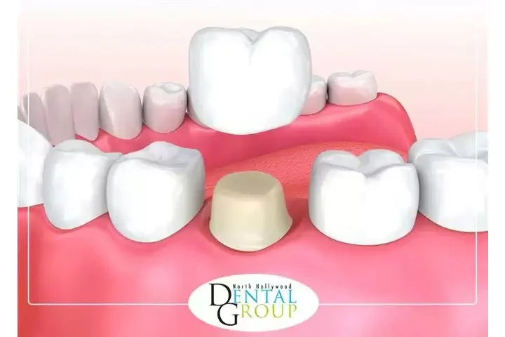 DENTISTA CERCA DE MÍ image 2