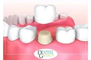 DENTISTA CERCA DE MÍ thumbnail