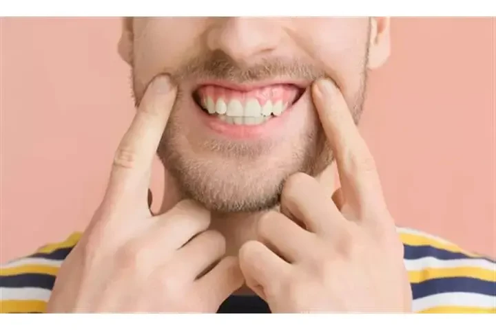 Dentista Cosmético image 2