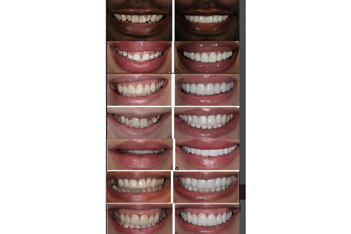 Selfie smiles dental image 2