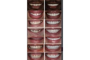 Selfie smiles dental thumbnail