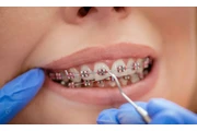 Dentista Cosmético thumbnail