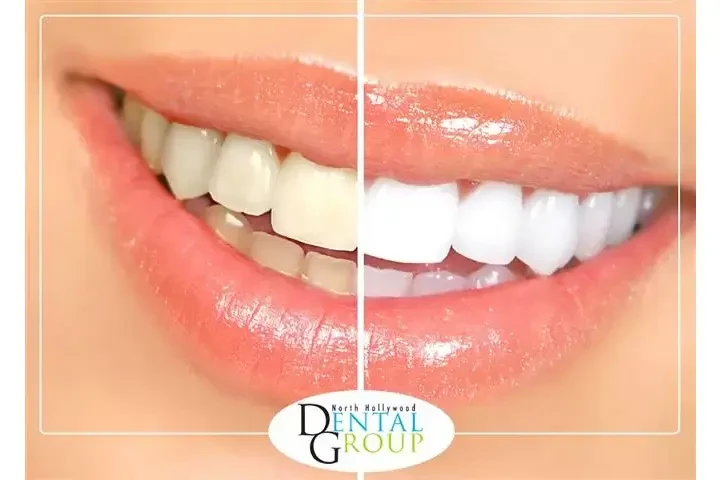 DENTISTA CERCA DE MÍ image 6