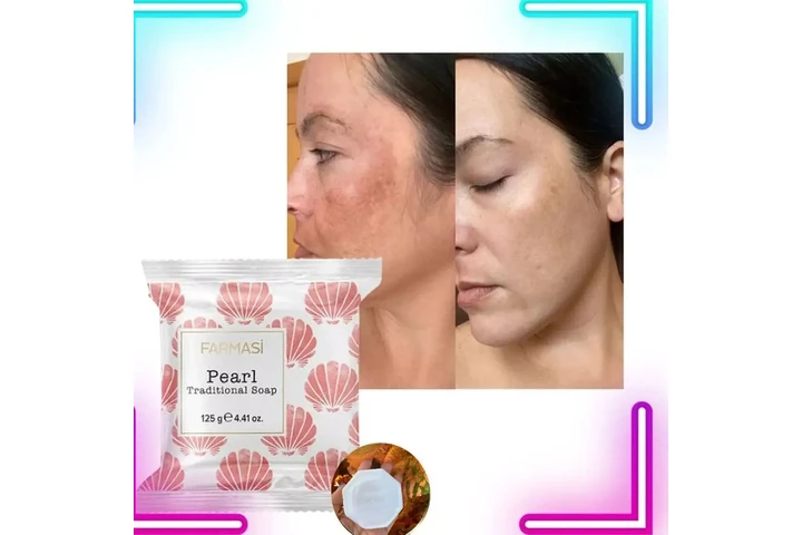 KIT ACNE O KITA MANCHAS image 5