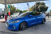 2017 Elantra SE thumbnail