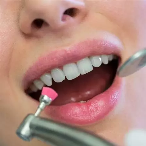 ODONTOLOGÍA COSMETICA image 9