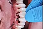 0800Dentistas thumbnail 3