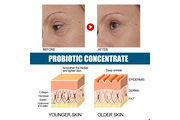 Probiotics Anti-Wrinkle Serum thumbnail