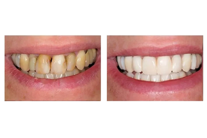 Hutchinson Metro Dental image 9