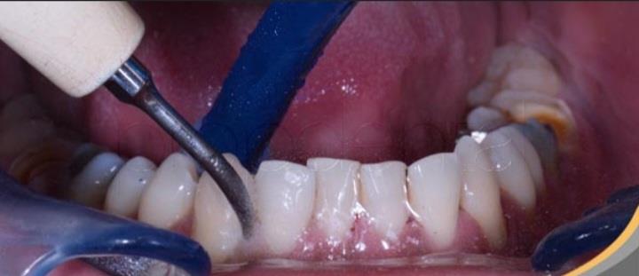 Servicio dental image 3