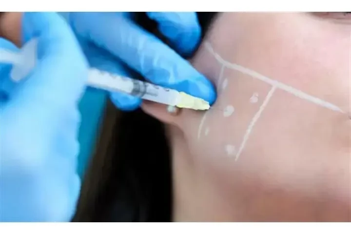 Dentista Cosmético image 7