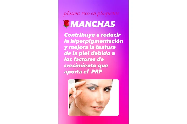 Plasma rico en plaquetas image 2