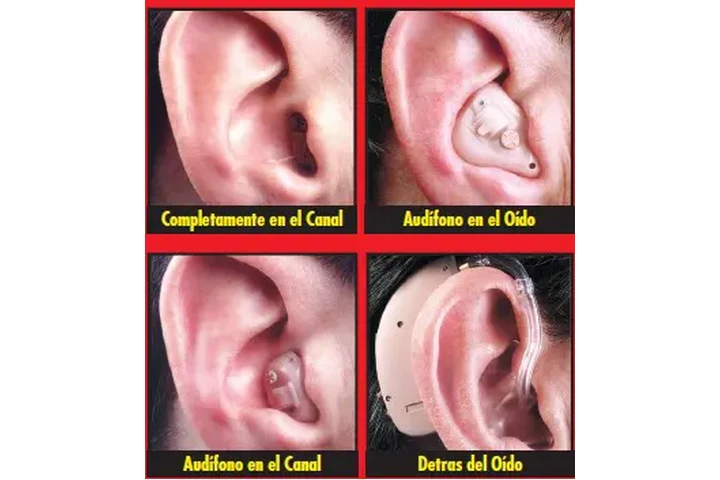 ¿Problemas para escuchar? image 2
