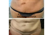 Siempre Bella Jhoss Spa thumbnail 4