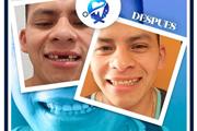 Dentista Familiar a bajo costo thumbnail