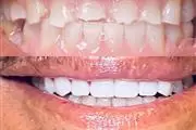 Selfie Smiles Dental Group thumbnail 2