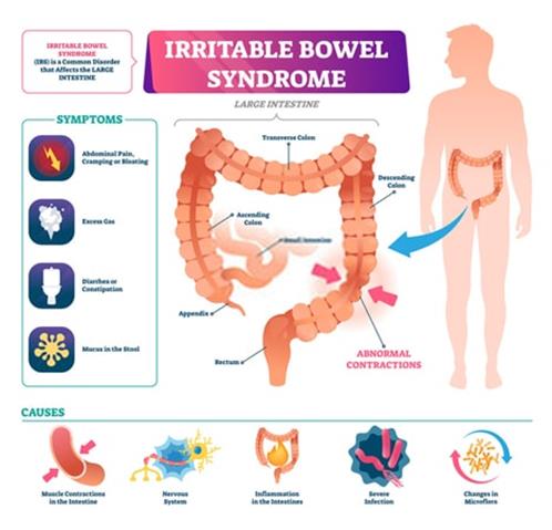 IBS treatment in NYC image 2