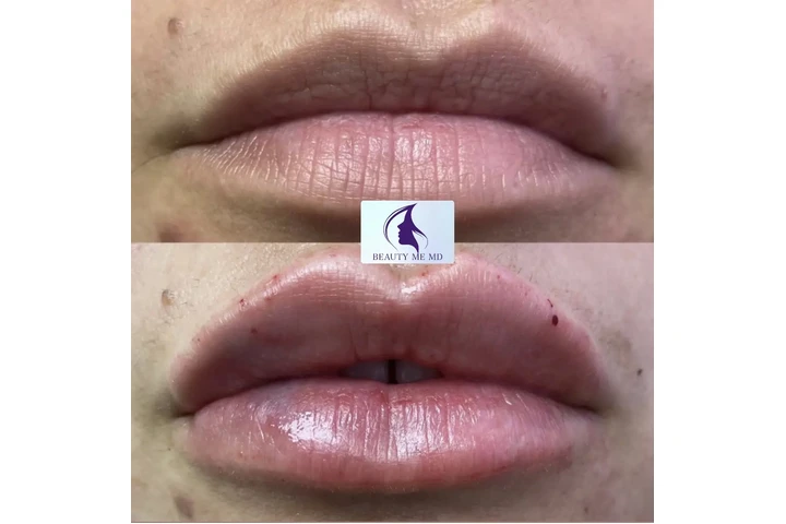 Aesthetic Treatments image 8