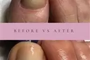 NAILS PEDICURE MANICURE GEL thumbnail