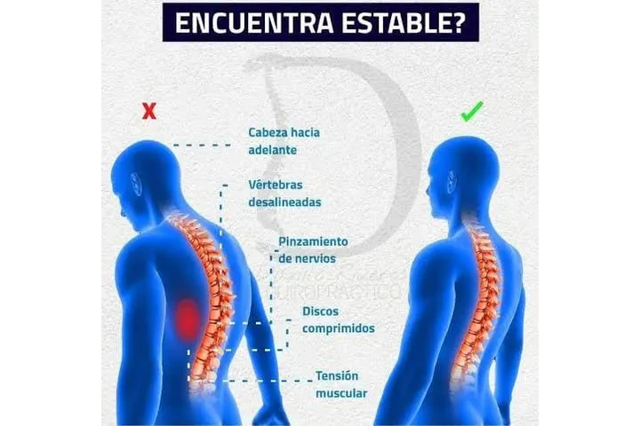 Quiropráctica para la salud image 1