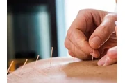 Acupuncture Toronto thumbnail