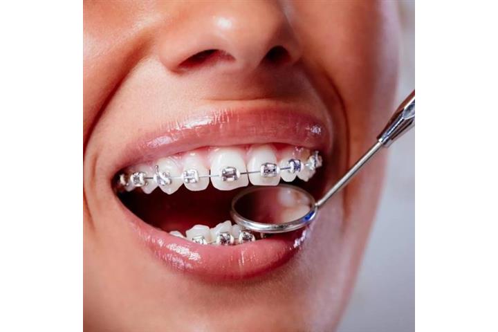 Implantes dentales desde $999 image 1