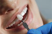 Implante dental en Escondido thumbnail