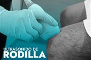 ULTRASONIDO DE RODILLA