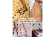 Bed Bugs-Chinches Fumigaciónes thumbnail