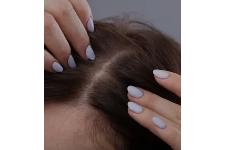 Consulta de Piel Gratis image 2