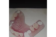 CLINICA DENTAL TECNICA DENTAL en Caracas
