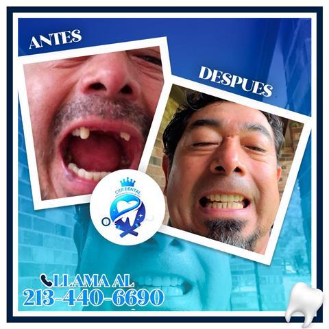 Dentista Familiar a bajo costo image 6