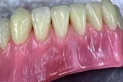 0800Dentistas thumbnail 4