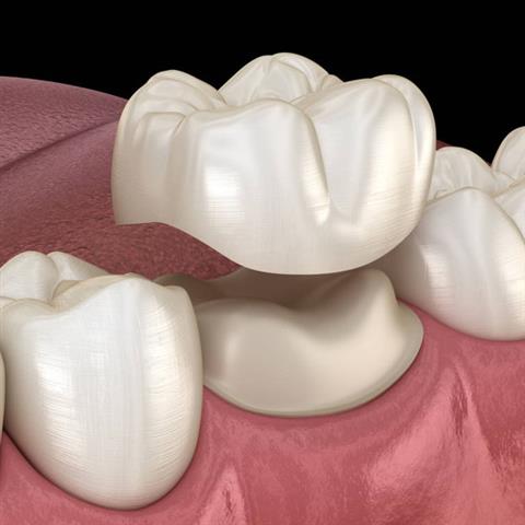 MARCOS TORRES DENTAL image 4