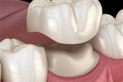 MARCOS TORRES DENTAL thumbnail 4