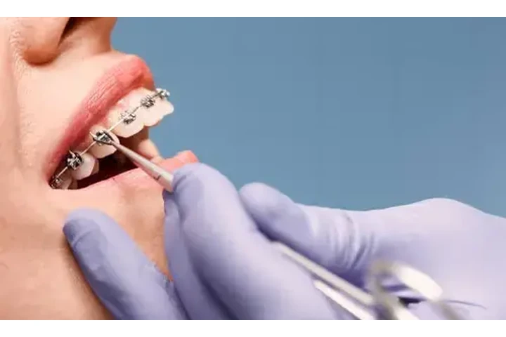 Implantes dentales desde $1999 image 1