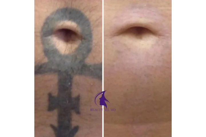 Aesthetic Treatments image 9