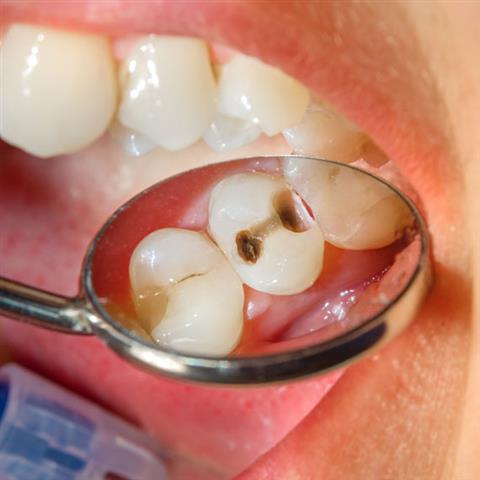 Dentista Cosmético image 3