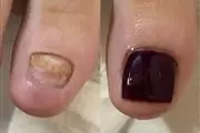 NAILS MANICURE PEDICURE GEL thumbnail