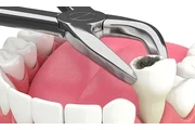 Dentista económico en Lynwood thumbnail