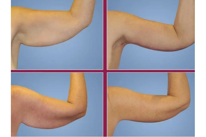 Sirugias consultas !!! image 4